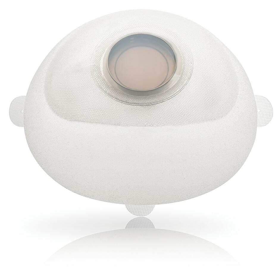 EXPANSOR TISULAR. EXPANSORES DE TEJIDO MAMARIO DE FORMA ANATÓMICA CON LENGÜETAS DE SUTURA EN POSICIONES 12, 3 Y 9 DE ALTURA BAJA, MEDIA Y BAJA EN DIFERENTES VOLUMENES LAS MEDIDAS ESTARÁN A CARGO DE LAS UNIDADES DE ATENCIÓN, DE ACUERDO A SUS NECESIDADES. Expansores de tejido mamario con lengüetas de sutura a las 12, 3 y 9 en la posición del reloj. Las cubiertas son fabricadas con capas reticuladas sucesivas de elastómero de silicona. Domo de inyección integrado de elastómero de silicona de al menos 50 mm de diámetro con detección magnética. Incorporan un área con tecnología autosellante alrededor del domo de inyección, que contiene gel de silicona, para minimizar y/o impedir fugas en caso de un pinchazo accidental con una aguja. Cuenta con cubierta texturizada. Se puede lograr la identificación del domo de inyección mediante el uso de un localizador magnético del puerto de inyección proporcionado con el expansor tisular. Las inyecciones deben efectuarse utilizando solución de cloruro de sodio U.S.P, estéril libre de pirógenos U.S.P. y en el área del domo de inyección. Altura: baja, media y alta. Volumen (cc): desde 250 cc hasta 850 cc Pieza.