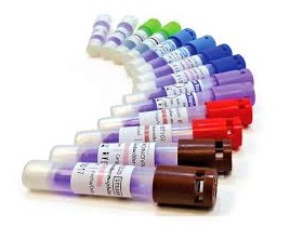 Testigos. Para validación del proceso de esterilización con óxido de etileno contiene: 1 disco con esporas de bacillus subtilis. 1 ampolleta de vidrio cintada con medio de cultivo líquido. 1 tira de cinta testigo sensible al calor. 1 tableta que funde a la temperatura de 55 °C ± 2 °C. Envase con 50 unidades.