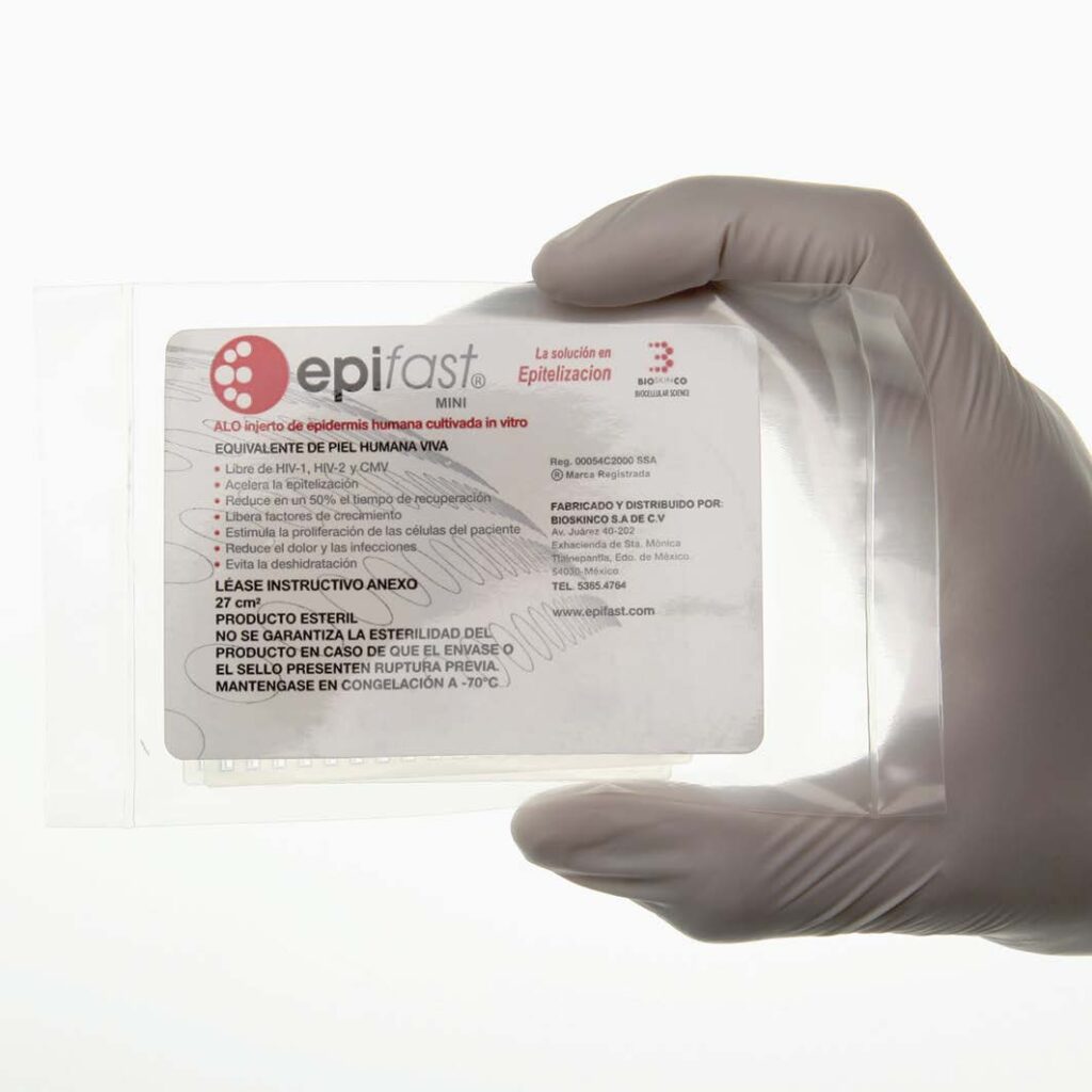 Injertos. Injerto de epidermis humana cultivado in vitro congelado. Estéril. Tamaño: 56 cm2. Pieza.